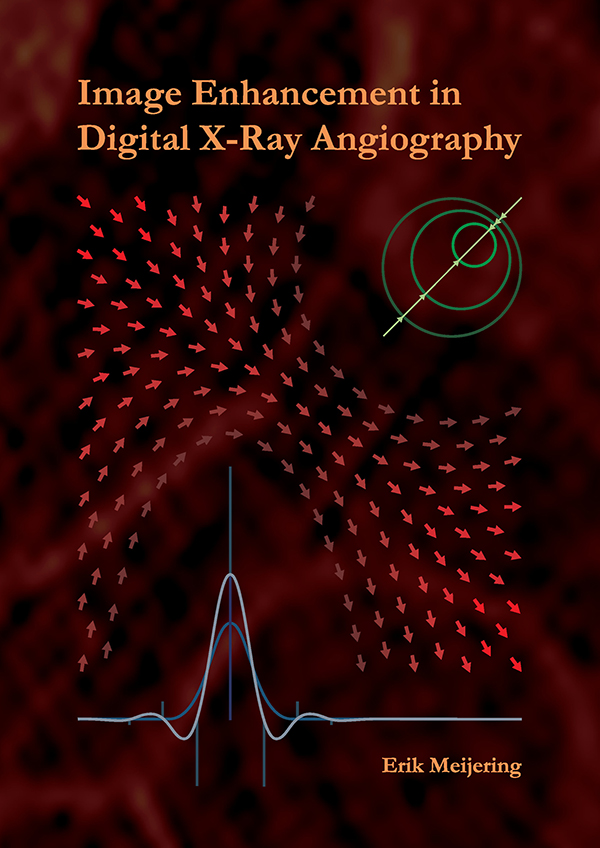 Thesis phd noise attenuation sweden